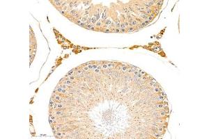 Immunohistochemistry of paraffin embedded rat testis using erf1 (ABIN7073895) at dilution of 1: 2400 (400x lens) (ETF1 anticorps)