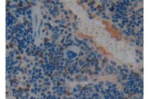 Detection of PAI1 in Mouse Spleen Tissue using Polyclonal Antibody to Plasminogen Activator Inhibitor 1 (PAI1)