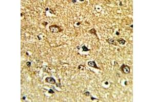 IHC analysis of FFPE human brain tissue with TH antibody (Tyrosine Hydroxylase anticorps  (AA 486-514))