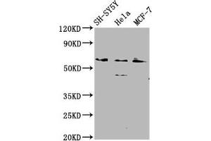 Western Blot Positive WB detected in: SH-SY5Y whole cell lysate, Hela whole cell lysate, MCF-7 whole cell lysate All lanes: RANBP10 antibody at 2. (RANBP1 anticorps  (AA 3-165))