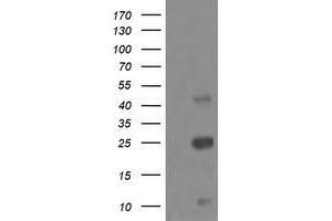 Western Blotting (WB) image for anti-Aldehyde Dehydrogenase 1 Family, Member A3 (ALDH1A3) (AA 1-100), (AA 413-512) antibody (ABIN2715886) (ALDH1A3 anticorps  (AA 1-100, AA 413-512))