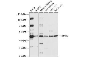 Western blot analysis of extracts of various cell lines, using TRNT1 antibody (ABIN7271005) at 1:1000 dilution. (Trnt1 anticorps  (AA 135-434))