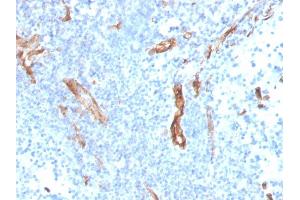 Formalin-fixed, paraffin-embedded human prostate stained with CD31 Mouse Monoclonal Antibody (PECAM1/3527). (CD31 anticorps  (AA 625-738))