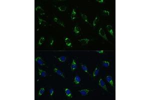 Immunofluorescence analysis of U-2 OS cells using I antibody (ABIN7265720) at dilution of 1:100.