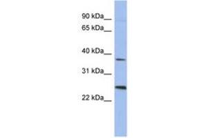 Image no. 1 for anti-Melanoma Antigen Family B, 2 (MAGEB2) (AA 71-120) antibody (ABIN6744051) (MAGEB2 anticorps  (AA 71-120))