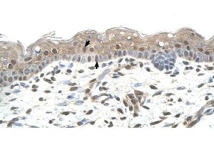 RNF25 antibody was used for immunohistochemistry at a concentration of 4-8 ug/ml to stain Squamous epithelial cells (arrows) in Human Skin.