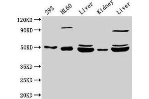 Western Blot Positive WB detected in: 293 whole cell lysate, HL60 whole cell lysate, Rat liver tissue, Mouse kidney tissue, Mouse liver tissue All lanes: NADK2 antibody at 4 μg/mL Secondary Goat polyclonal to rabbit IgG at 1/50000 dilution Predicted band size: 50, 46, 32 kDa Observed band size: 50, 46 kDa