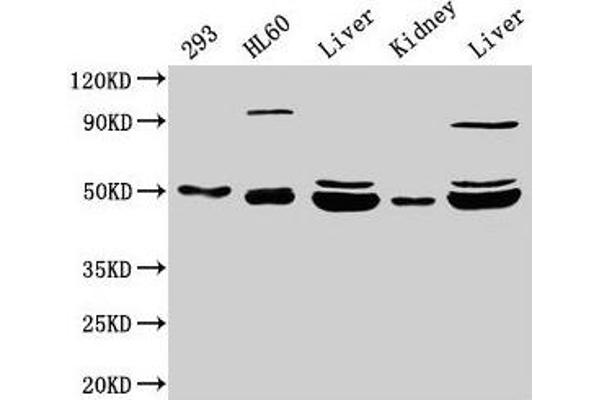 NADK2 anticorps  (AA 16-156)