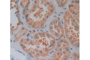 Used in DAB staining on fromalin fixed paraffin- embedded kidney tissue (LYPLA2 anticorps  (AA 1-196))
