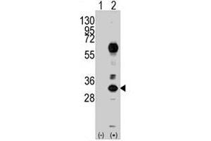 Western blot analysis of CD8A (arrow) using rabbit CD8A polyclonal antibody . (CD8 alpha anticorps  (N-Term))
