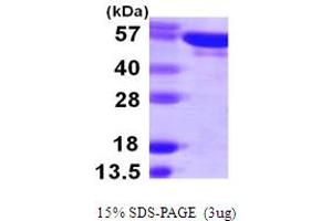 SDS-PAGE (SDS) image for Tyrosyl-tRNA Synthetase (Yars) (AA 1-528) protein (His tag) (ABIN7279434) (YARS Protein (AA 1-528) (His tag))