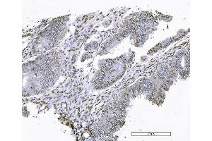 IHC analysis of FOXK1 using anti-FOXK1 antibody (ABIN7600295). (Foxk1 anticorps  (AA 175-671))