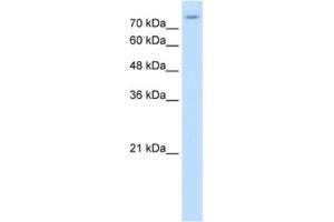 Western Blotting (WB) image for anti-Solute Carrier Family 20 (Phosphate Transporter), Member 2 (SLC20A2) antibody (ABIN2462564) (SLC20A2 anticorps)
