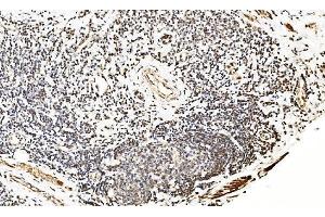 IHC analysis of LSM2 using anti-LSM2 antibody (ABIN7602832).