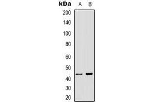 Western blot analysis of ARMCX3 expression in A431 (A), HEK293T (B) whole cell lysates. (ARMCX3 anticorps  (C-Term))