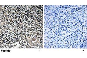 Immunohistochemistry analysis of paraffin-embedded human thymus gland tissue using CBLN4 polyclonal antibody .