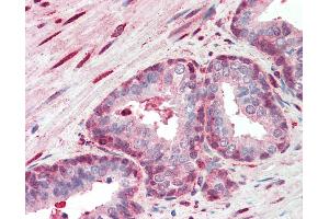 Anti-SRSF2 / SC35 antibody IHC staining of human prostate.