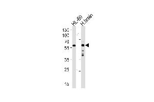 Western blot analysis of lysates from HL-60 cell line and human brain tissue lysate (from left to right), using CSIN1 Antibody  (ABIN392665 and ABIN2842163).