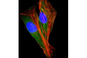 Immunofluorescent analysis of 4 % paraformaldehyde-fixed, 0.