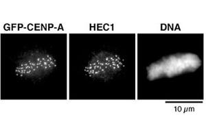 Immunofluorescent staining of mitotic Hela cell line stably expressing a GFP-CENP-A fusion protein followed by antibody against EGFP (left). (eGFP anticorps)