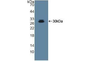 Detection of Recombinant ADAM10, Human using Polyclonal Antibody to A Disintegrin And Metalloprotease 10 (ADAM10) (ADAM10 anticorps  (AA 420-641))