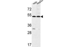 Western Blotting (WB) image for anti-Fermitin Family Member 1 (FERMT1) antibody (ABIN3003961) (FERMT1 anticorps)