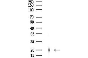 anti-Family with Sequence Similarity 210, Member B (FAM210B) antibody
