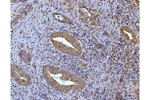 IHC analysis of Glutaminase/GLS using anti-Glutaminase/GLS antibody (ABIN7601602). (Glutaminase anticorps  (AA 396-654))