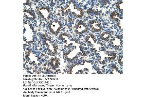 Rabbit Anti-RPL8 Antibody  Paraffin Embedded Tissue: Human Lung Cellular Data: Alveolar cells Antibody Concentration: 4. (RPL8 anticorps  (C-Term))