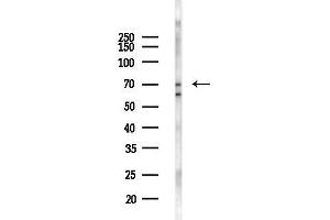 anti-Fermitin Family Member 1 (FERMT1) (Internal Region) antibody
