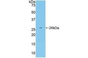 Detection of Recombinant Grb7, Mouse using Polyclonal Antibody to Growth Factor Receptor Bound Protein 7 (Grb7) (GRB7 anticorps  (AA 298-489))