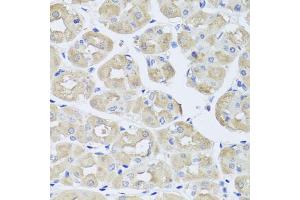 Immunohistochemistry of paraffin-embedded human stomach using BGLAP antibody (ABIN5975009) at dilution of 1/100 (40x lens). (Osteocalcin anticorps)