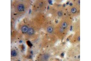 Used in DAB staining on fromalin fixed paraffin-embedded Liver tissue (IGF2 anticorps  (AA 25-91))