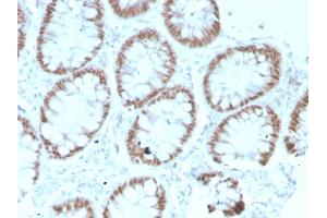Formalin-fixed, paraffin-embedded human Colon stained with CDX2 Mouse Monoclonal Antibody (rCDX2/1690). (Recombinant CDX2 anticorps  (AA 150-249))