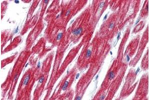 Anti-OLFM4 antibody  ABIN1103389 IHC staining of human heart.