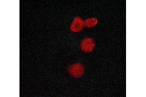 ABIN6269067 staining Hela cells by ICC/IF. (MSK1 anticorps  (Internal Region))
