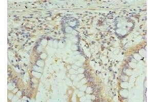 Immunohistochemistry of paraffin-embedded human small intestine tissue using ABIN7153593 at dilution of 1:100