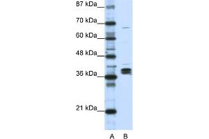 WB Suggested Anti-HNRPDL Antibody Titration:  1. (HNRPDL anticorps  (Middle Region))