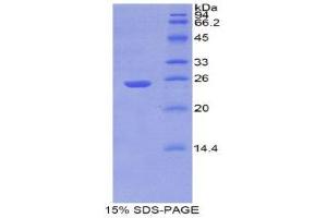 SDS-PAGE (SDS) image for Aminopeptidase Puromycin Sensitive (NPEPPS) (AA 584-793) protein (His tag) (ABIN1080607)