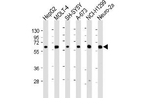 All lanes : Anti-CHRNA4 Antibody (N-Term) at 1:2000 dilution Lane 1: HepG2 whole cell lysate Lane 2: MOLT-4 whole cell lysate Lane 3: SH-SY5Y whole cell lysate Lane 4: A-673 whole cell lysate Lane 5: NCI- whole cell lysate Lane 6: Neuro-2a whole cell lysate Lysates/proteins at 20 μg per lane. (CHRNA4 anticorps  (AA 176-208))
