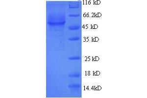 SDS-PAGE (SDS) image for Galactosidase, alpha (GLA) (AA 1-432), (full length) protein (His tag) (ABIN5714290)