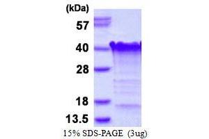 Image no. 1 for Transcription Elongation Factor A (SII)-Like 3 (TCEAL3) (AA 1-200) protein (His tag) (ABIN7529200)