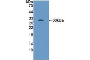 Detection of Recombinant GAB3, Mouse using Polyclonal Antibody to GRB2 Associated Binding Protein 3 (GAB3) (GAB3 anticorps  (AA 142-375))