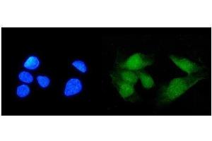IF analysis of TRIM21/SS-A using anti-TRIM21/SS-A antibody (ABIN7599820). (TRIM21 anticorps  (AA 12-475))
