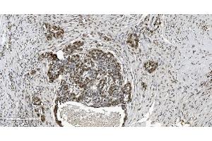 IHC analysis of HP1 alpha/CBX5 using anti-HP1 alpha/CBX5 antibody (ABIN7599057). (CBX5 anticorps  (AA 1-191))