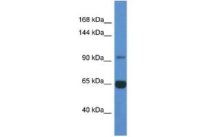 WB Suggested Anti-Man2a2 Antibody   Titration: 1. (MAN2A2 anticorps  (N-Term))
