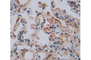 IHC-P analysis of lung tissue, with DAB staining.