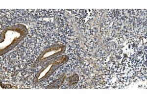 IHC analysis of NOX2/gp91phox/CYBB using anti-NOX2/gp91phox/CYBB antibody (ABIN7599875). (CYBB anticorps  (AA 124-559))