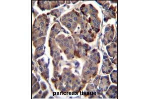 RAB11B Antibody (C-term) (ABIN1881719 and ABIN2846071) immunohistochemistry analysis in formalin fixed and paraffin embedded human pancreas tissue followed by peroxidase conjugation of the secondary antibody and DAB staining. (RAB11B anticorps  (C-Term))