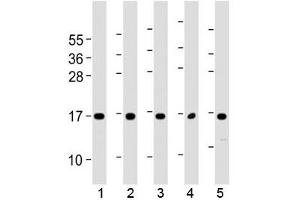 Western blot testing of human 1) 293T/17, 2) HUVEC, 3) K562, 4) NCI-H460 and 5) PC-3 cell lysate with Eotaxin-3 antibody at 1:2000.